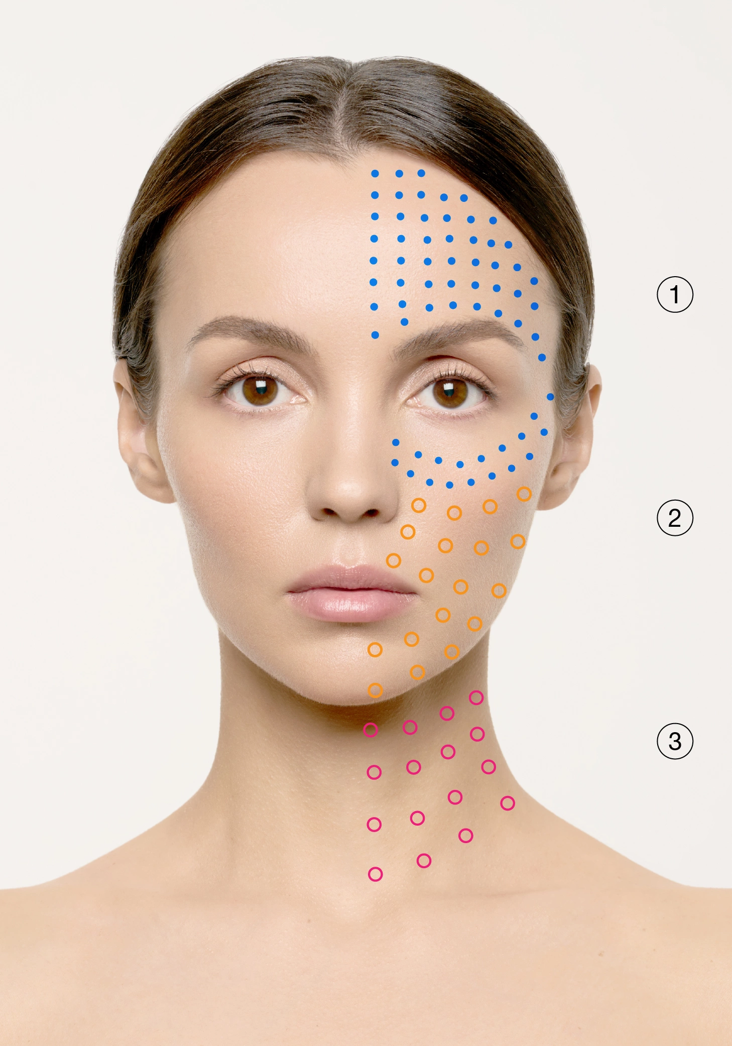 Pigmentation & Rosacea